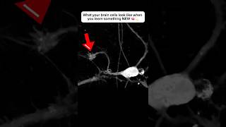 Brain cell restructures itself after forming a new connection neuroplasticity neuroscience brain [upl. by Anadroj]