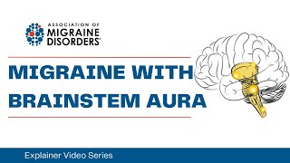 What is Migraine with Brainstem Aura  Chapter 1 Migraine Types  Explainer Video Series [upl. by Nuri]