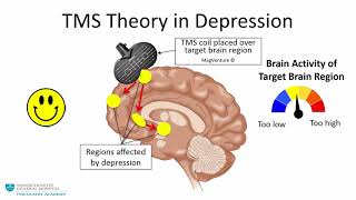 Transcranial Magnetic Stimulation A New Treatment Approach for Psychiatric Disorders [upl. by Uhej]