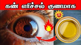 கண் எரிச்சல் குணமாக  How to cure eye irritation in tamil DrRajalakshmi  TCH [upl. by Joachim215]