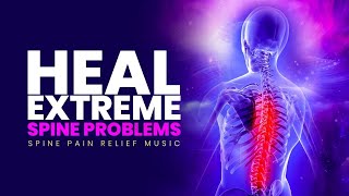 Set Up Your Spinal Cord  Heal Extreme Spine Problems  Spine Pain Relief Music  Isochronic Tones [upl. by Atirma]