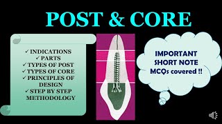 POST amp CORE  RESTORATION OF ENDODONTICALLY TREATED TOOTH [upl. by Bonnette558]