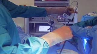 Laparoscopic Hysterectomy [upl. by Eiliah912]