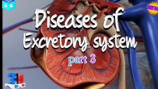 Excretory System Diseases Understanding the Impact on our Health  Class 11 Biology neet biology [upl. by Hamid]