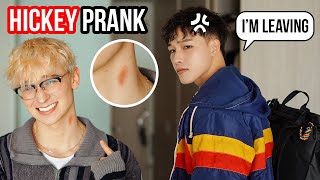 Who gave you that Hickey 😡💢 【Cute Gay Couple 😂 Funny Prank】 [upl. by Takken]