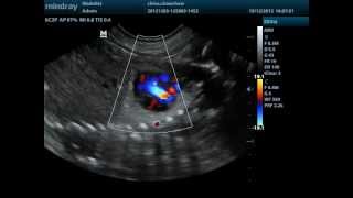 Doppler cardiaco fetal canino [upl. by Dulcine515]