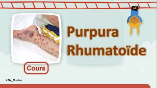 Enfant avec tâches purpuriques cutanées👶  📚 Purpura Rhumatoïde  Cours  Pédiatrie [upl. by Naillimixam]