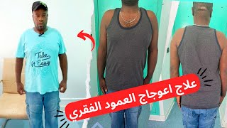 ✅ scoliose شفاء مريض من اعوجاج العمود الفقري [upl. by Anialeh813]