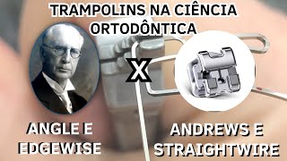 Qual a diferença dos aparelhos Edgewise para os aparelhos Straightwire  Aula 128 [upl. by Olra]