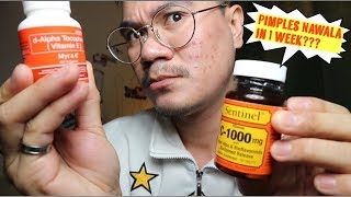 MYRA E 400 EFFECTIVE NGA BA 1 WEEK PRODUCT REVIEW  Dennis Vlog 51 [upl. by Nevur]