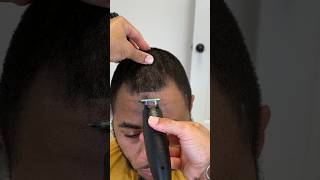 Fix Your Receding Hairline And Get Your Confidence Back [upl. by Diego]