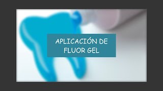 APLICACION DE FLUOR GEL [upl. by Aspia308]