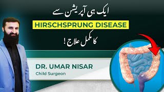 Hirschsprungs Disease Single Surgery Treatment Unveiled by Dr Umar Nisar [upl. by Anaiv]