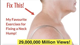 How to Fix a Neck Hump at Home FAST  With FREE Exercise Sheet [upl. by Beaudoin]