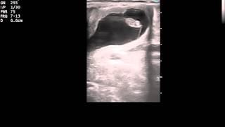 Ultrasound of a 27 day equine pregnancy [upl. by Masha301]