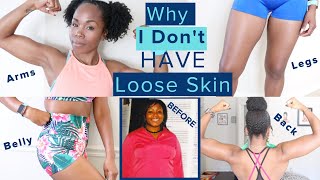 Why I Dont Have LOOSE SKIN After 100 Pound Weight Loss WITHOUT Surgery  TMI Skincare amp Nutrition [upl. by Renwick]