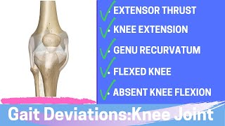 Gait Deviations Knee Joint Complex Secondary to Knee Joint Dysfunction [upl. by Adiene]