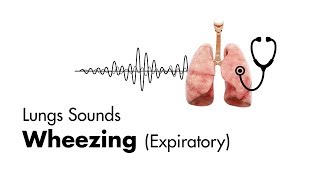 Wheezing expiratory  Lung Sounds  MEDZCOOL [upl. by Elletnahs]