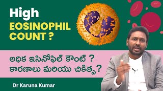 Reasons for High Eosinophil Counts  How to Reduce Eosinophils  Dr Karuna Kumar Hematologist [upl. by Kral]