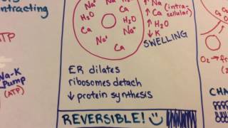 Ischemic Reperfusion Injury [upl. by Ycnay]