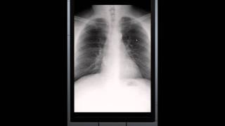 Easy DICOM Viewer for Windows Phone 7 [upl. by Kehoe]