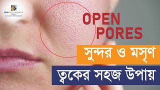 Treatments and Skin Care for Open Pores  Dr Tasnim Khan [upl. by Nylodam]