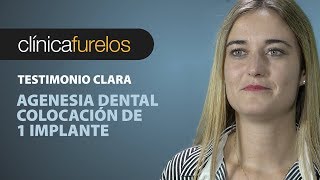 Clara  Agenesia dental [upl. by Mcwilliams]