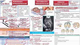 10 COMPLICACIONES LEUCOMALACIA PERIVENTR PARALISIS CEREBRAL INFANTIL [upl. by Acenom656]