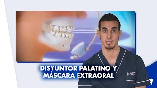 DISYUNTOR PALATINO y MÁSCARA facial de ORTODONCIA  Preguntas frecuentes  Shorts [upl. by Nyrahtak]