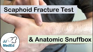 Scaphoid Fracture Test Clinical Exam and the Anatomic Snuffbox [upl. by Nolyar]