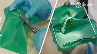 Basics of Dental Rubber Dam Placement [upl. by Arama]