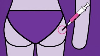 Brook Contraception  Contraceptive Injection Animation [upl. by Johm590]