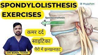 Spondylolisthesis Exercises  Spondylolisthesis physiotherapy treatment  L4L5 L5S1  Sciatica [upl. by Huei]