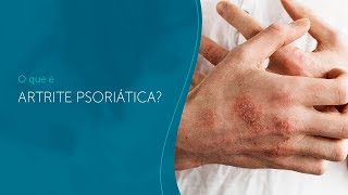 O que é Artrite Psoriática [upl. by Meuse]