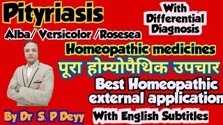 Pityriasis  सेहुआ  सफेद दाग  फीका दाग  Best Homeopathic Medicines [upl. by Theone364]