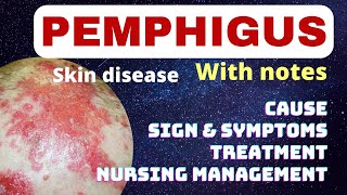 Pemphigus in hindi  cause symptoms treatment nursing management  pemphigus skin problem  msn [upl. by Slin16]