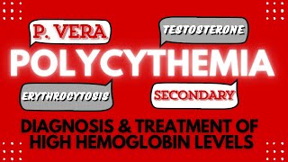 Polycythemia Diagnosis amp Treatment of Elevated Hemoglobin Level [upl. by Eniawed998]