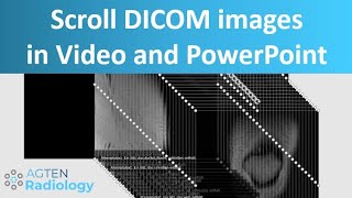 How To Scroll DICOM Images In Video Presentations And PowerPoint [upl. by Rimahs]