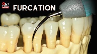 FURCATION The anatomic area of a multirooted tooth where the roots diverge [upl. by Eenalem841]