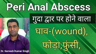 Know more about PeriAnal Abscessमल द्वार पर होने वाला घाव फोड़ा फुंसी मवाद बहना के बारे में [upl. by Anuaik]