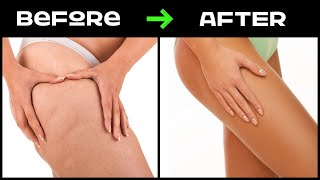 Reduce Cellulite in 2 Weeks Workout amp Burn Thigh Fat Guide [upl. by Ycats]