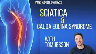 Understanding Sciatica and Cauda Equina Syndrome with Tom Jesson [upl. by Yecak138]