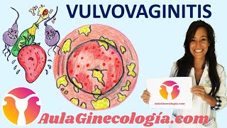 VULVOVAGINITIS Síntomas causas diagnóstico y tratamiento  Ginecología y Obstetricia [upl. by Ball]