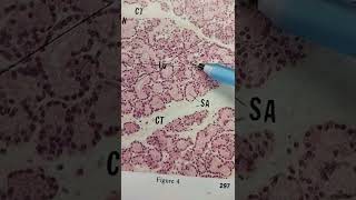 Lacrimal Gland Histology Quick Overview [upl. by Furnary]