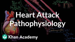 Heart attack myocardial infarction pathophysiology  NCLEXRN  Khan Academy [upl. by Berlauda]