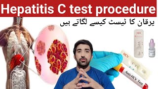 Anti HCV test  How to do Hepatitis C test  test procedure viralvideo youtube medical [upl. by Aihsetal480]