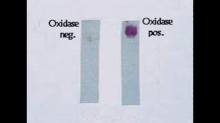 Oxidase Test [upl. by Nelleoj]