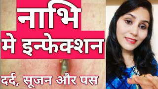 Home Remedies for Belly Button Infection  Simmi Makeover [upl. by Arther]