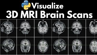 Neuroimaging Visualize 3D MRI Brain Scans with Python [upl. by Schargel]