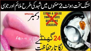 How to Heal Chapped Lips Fast Winter Special Lips Care Hack Skincare Tips at home [upl. by Landre]